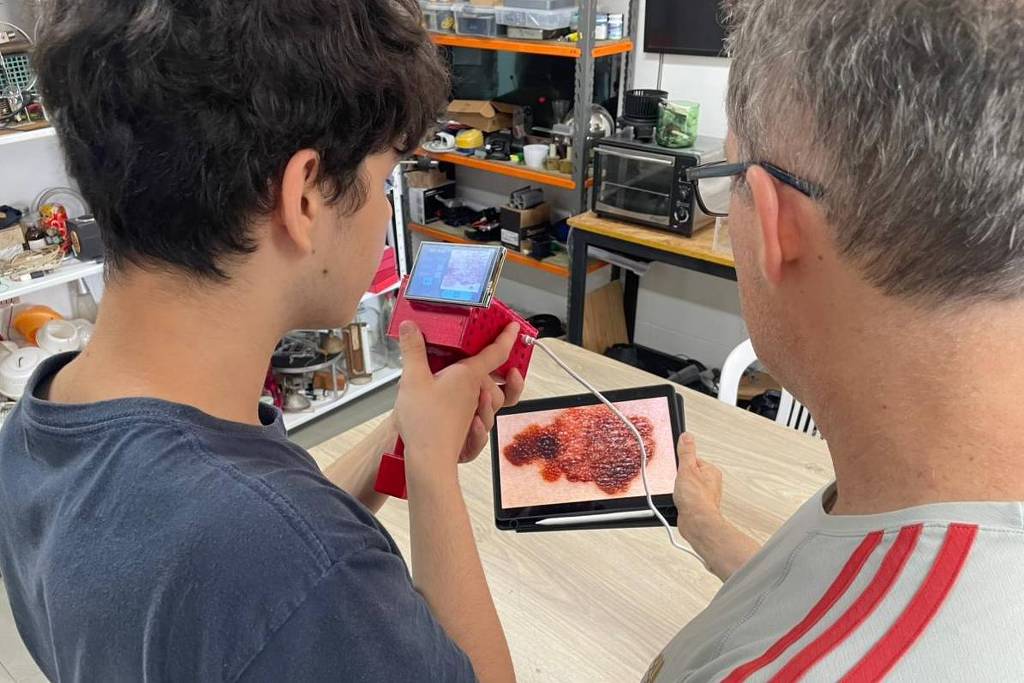 projeto-de-escola-no-rs-cria-tecnologia-para-identificar-sinais-de-cancer-de-pele-com-ia