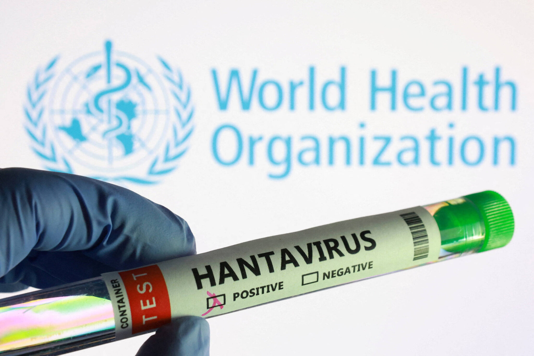 instituto-argentino-que-pesquisa-hantavirus-sofre-com-cortes-orcamentarios-de-milei