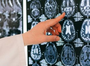 uso-de-ia-pode-prejudicar-capacidade-de-medicos-em-detectar-sinais-de-cancer,-aponta-estudo